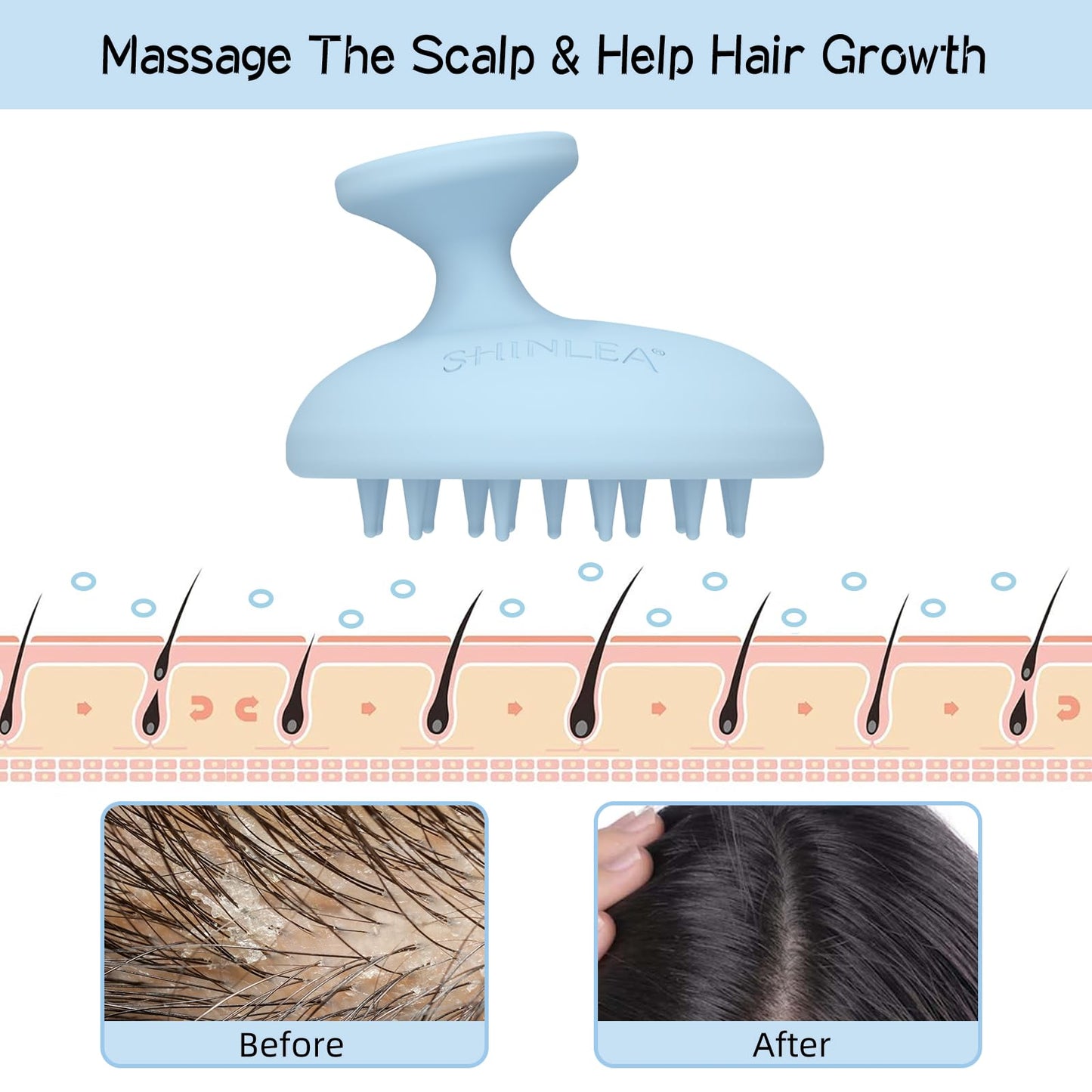 SHINLEA Silicone Scalp Massager Shampoo Brush